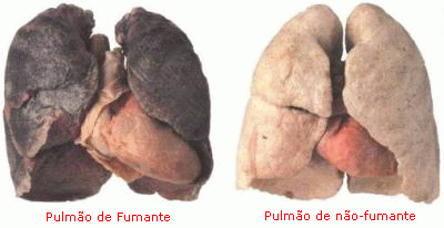 pulmoes